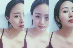 私密整形女,重塑自信，绽放美丽风采